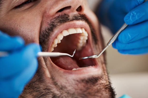 Emergency Dental Services in Wenatchee, WA